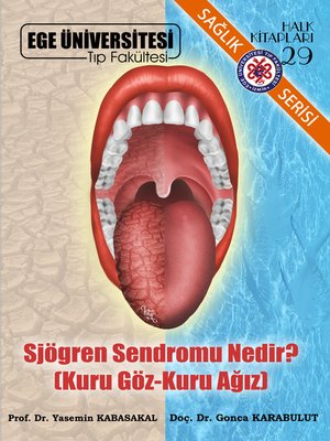 cover image of Sjögren Sendromu Nedir? (Kuru Göz- Kuru Ağız)